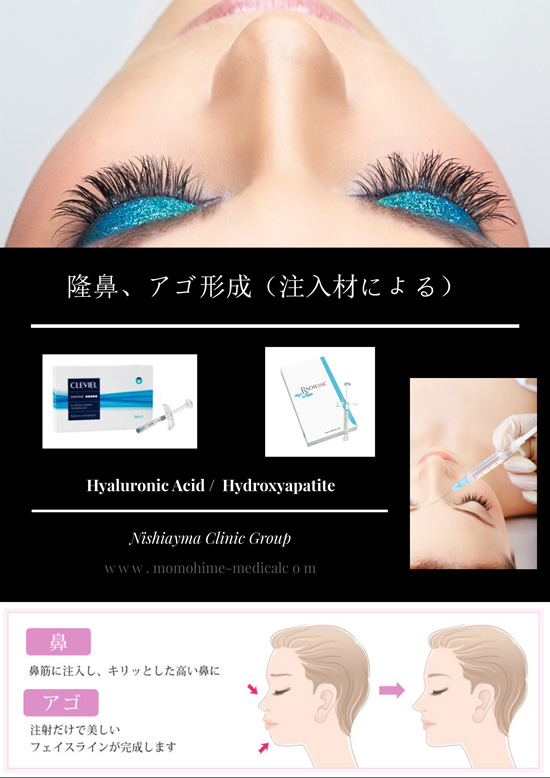 dermal-filler-nishiyama-3s.jpg