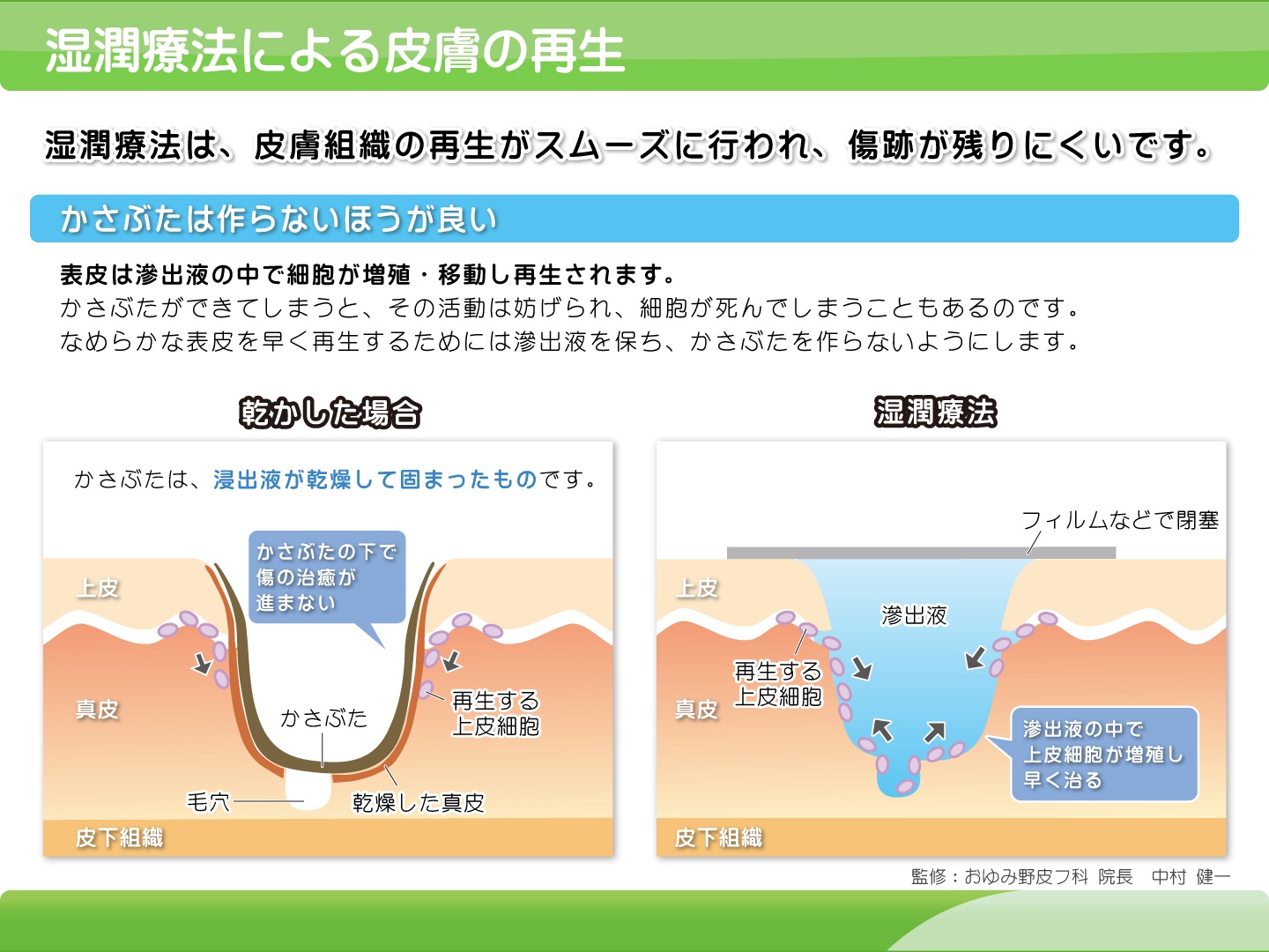 湿潤 療法 と は