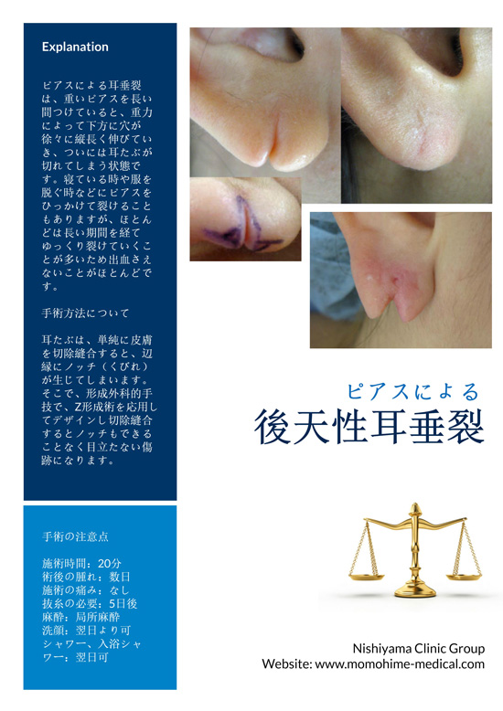 ear-cleft-nishiyama-1s.jpg