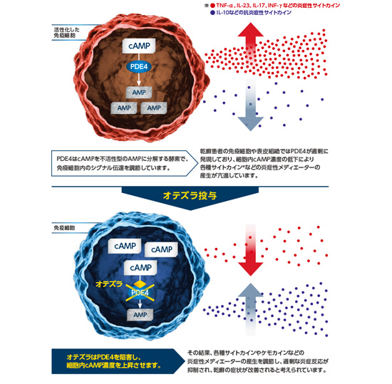 尋常乾癬「オテズラ錠」について/にしやま由美東京銀座クリニック(東京銀座2丁目) にしやま由美東京銀座クリニック